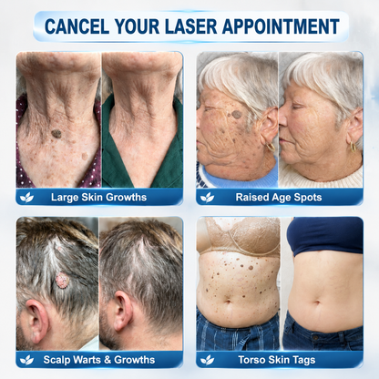 𝐇𝐞𝐚𝐥𝒓𝒊𝒛𝒆® 💃💃7-𝐃𝐚𝐲 𝐒𝐤𝐢𝐧 𝐓𝐚𝐠 & 𝐒𝐩𝐨𝐭 𝐄𝐫𝐚𝐬𝐞𝐫 𝐂𝐫𝐞𝐚𝐦 (Zero Pain, Zero 𝐒𝐜𝐚𝐫𝐬 Formula)